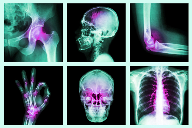 Brain Injury Case Results