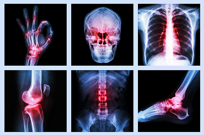 Brain injury